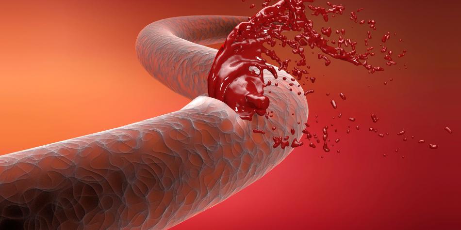 Las terapias génicas experimentales empujan la hemofilia hacia el precipicio de tratamiento duradero