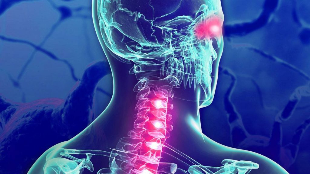 neuromielitis óptica