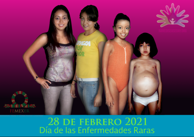 Día de las Enfermedades Raras 2021