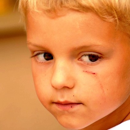 La verdad sobre la amenaza de COVID para los niños después de la recuperación