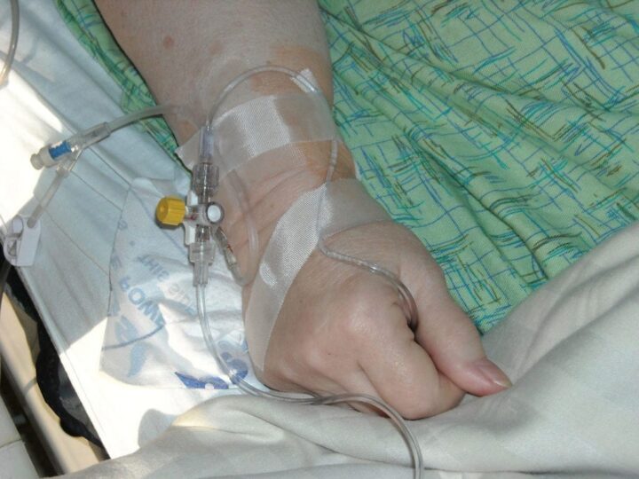 Secukinumab eficaz para tratar la artritis idiopática juvenil